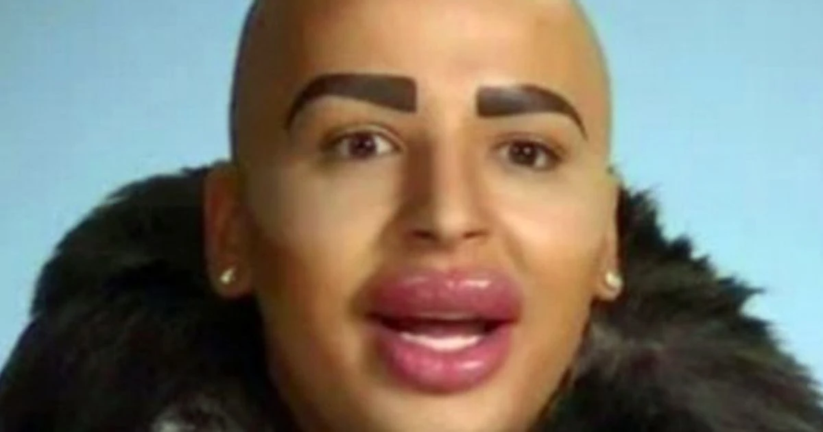 ਬ੍ਰਿਟੇਨ ਦੇ 'ਲਿਪ ਕਿੰਗ' ਜੋਰਡਨ ਜੇਮਜ਼ ਦੀ ਮੌਤ, ਪਰਿਵਾਰ ਦੁਖੀ