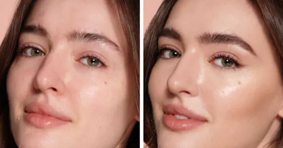 ਸ਼ਾਰਲਟ ਟਿਲਬਰੀ ਦਾ ਮੁਫ਼ਤ ਫਾਰਮੂਲਾ ਮਿਲਣ ਦਾ ਮੌਕਾ